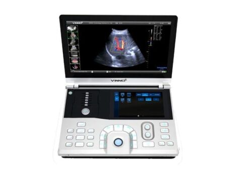 Vinno 5 Portable Ultrasound Diagnostic System