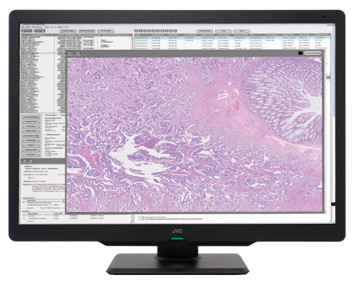 JVC 6MP 30" Color Radiology Monitor CL-S600 'New, Unused'