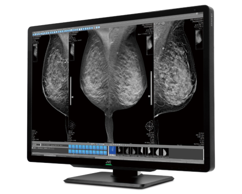 JVC 12MP 30.9" Color Radiology Monitor - CL-S1200 'New, Unused'