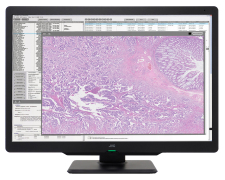 JVC 6MP 30" Color Radiology Monitor CL-S600 'New, Unused'
